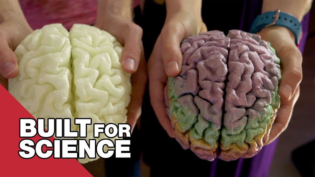 I Got To See And Hold My Brain